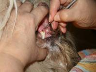 Zahnstein entfernen Zahnstein entfernen